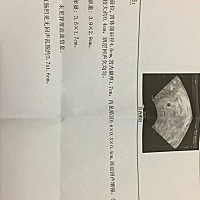 今天又去检查了，因为医院查血的仪器除了问题，HCG要明天才能拿到结果，医生一直说不乐观，不管如何，希...