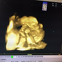 今天做了四维 ，在肚子里都知道调皮😝，一直不配合，附上图片 只看到一半 不是很清楚 一直用手遮住脸...