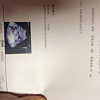 看的出这是男宝还是女宝么？