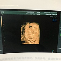 帮忙看看是男是女？