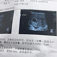 今天去医院做彩超了！宝宝很健康。