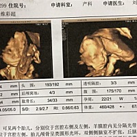 我的宝贝们，你们健康就好，再苦再累也值得😘