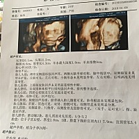 各位有经验的宝妈可以看出男孩女孩吗