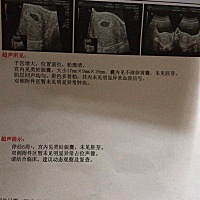 第一次抽血照b超，抽血检查结果是9点几孕铜，医生说比较低，开了一个星期的黄体酮针和保胎药、孕铜药，...