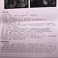 不会看，还有三个月宝宝就出生了，所有检查一次性通过，宝宝真给力