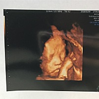 大家帮忙看看是男宝还是女宝啊，新鲜出炉的。好激动