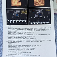 2018年1月10号四维通过 嘿嘿😁