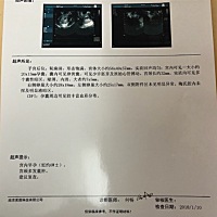 这样能看出什么吗？左盼右盼怀上了。但愿宝宝健康平安