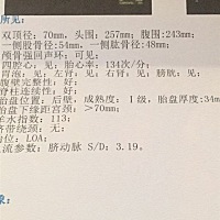 谁能帮我看下是女孩还是男孩啊？头胎30周。