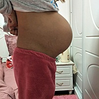 早上流了咖啡色分泌物是什么呀？要不要去医院哦