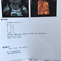 今天刚出的四维单子看男女