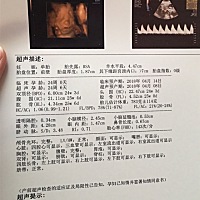 大家帮忙看看是男孩还是女孩呗...