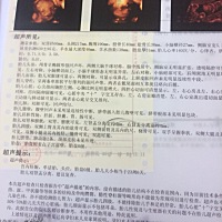 看看男女^_^，希望是女宝