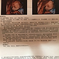 有没有会看男宝女宝的阿。还有两个多月就生了 好激动👀