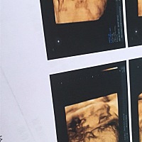 大家看看像男宝 女宝