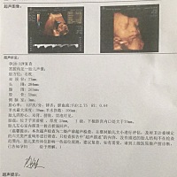 哈哈 产检宝宝健康 好奇男宝还是女宝 有能看懂的嘛？