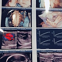 看到宝宝的样子好激动，刚刚做了四维，很好奇男孩女孩……