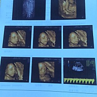 亲爱的各位宝妈们，帮忙看看是男孩儿👦还是女孩儿👧？