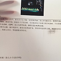 39周了，B超数据相当于35周，胎儿偏小正常吗