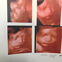 儿子还是女儿呀😄