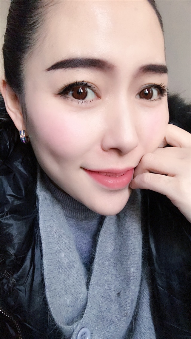 第二张胖到酒窝都有了，怎么得了😓