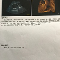 刚做的、有能看懂的姐妹帮忙看一下是男宝还是女宝啊，很好奇
