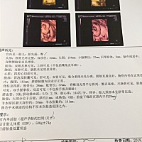 有会看男女的宝妈嘛？