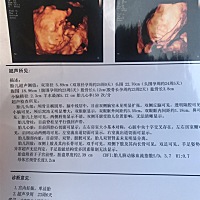 请大家看看是男孩还是女孩