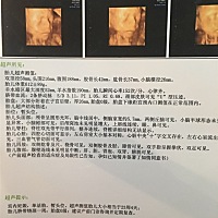 亲爱的宝妈们帮忙看一下性别？谢谢……