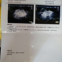 检查说纵隔子宫，刚开始两家说呈y字型，今天检查说v字型，但是都是只有一点点，看都看不清，都算不上综...