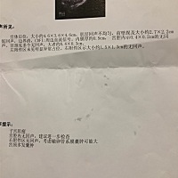 今天刚做的，怎么这么小，里边还各种囊肿，还有子宫肌瘤，医生说没事，圈子里有没有大夫啊，看到这样的...