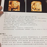 今天做四维 好奇是男孩还是女孩 会看的亲们帮忙看看  😁