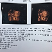 有预产期4月底的宝妈吗？