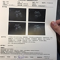 各位最晚多久有胎心啊