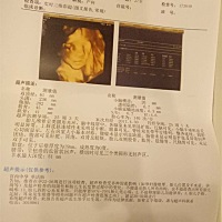 看得出是男孩还是女孩？