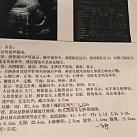 好想知道是男宝还是女宝