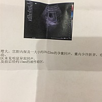 帮忙看一下我怀的是男宝还是女宝啊，比较好奇！拜托🙏