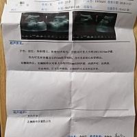 请大神们看看能看出男孩女孩么，第一胎