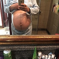 前两天肚子不规律阵痛还以为要生了，害我激动了好久。昨天和今天居然一点都不痛了，你这是在玩我吗？宝...