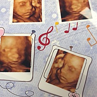 就是觉得丑，怎么办，大哭