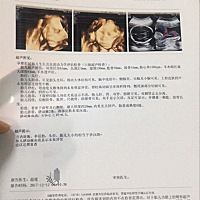 怎么看是男孩还是女孩？？