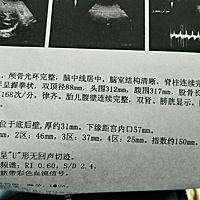 有会看男女的宝宝吗？麻烦看一下