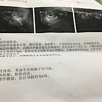 子宫纵膈没手术，现孕5周多，这两天有点褐色分泌物，去医院首次检查。阴超如下，孕酮值还没出结果，希望...