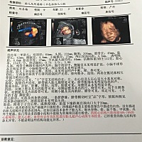 四维通过 有经验的大神给帮忙看看是男宝宝还是女宝宝