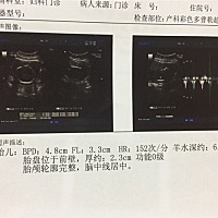 有懂的孕妈吗？能帮忙看一下孩子各种指数正常吗？这张彩超是大约20周的。