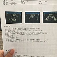 这是男孩女孩呢，又会看的吗