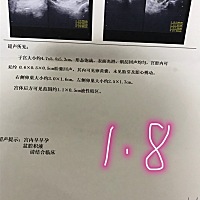 末次月经11月24号，因为月经偶尔错后，医生按36天周期算的，认为我现在可能是42三天吧，这之间，八号有...