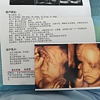 各位宝妈们帮我看下男孩还是女孩谢谢，很好奇