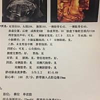 请有经验的宝妈帮我看看男宝还是女包，特别好奇