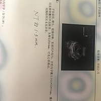 有知道是男孩还是女孩的宝妈吗，好奇